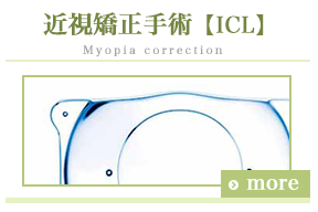 近視矯正手術（ICL）