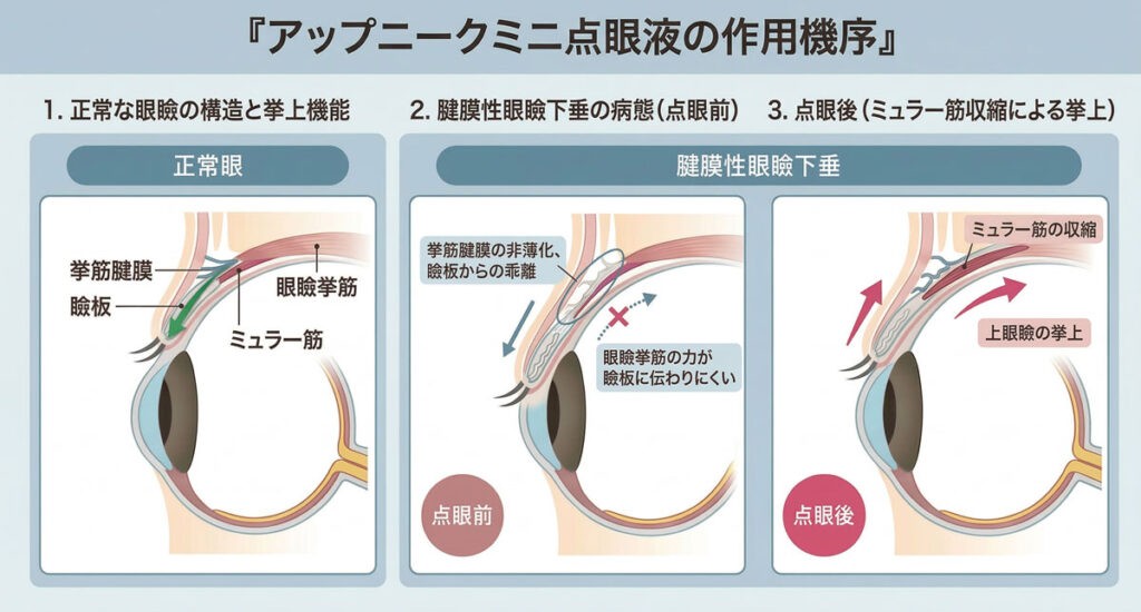 アップニークミニ点眼液の作用機序